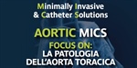 GVM Campus. Aortic Mics Focus On: La patologia dell’aorta toracica